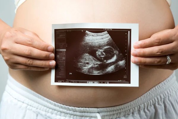 Mulher grávida Fotos De Bancos De Imagens