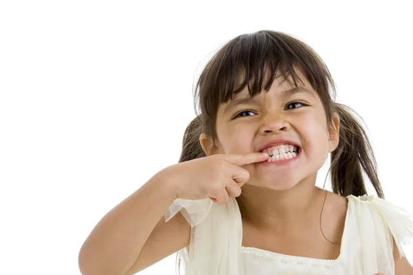 Beyaz Arka Plan Üzerinde Izole Dişlerini Gösteren Şirin Küçük Kız — Stok fotoğraf