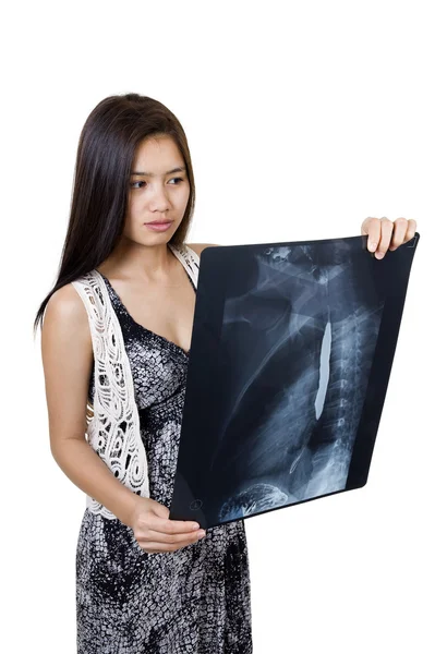 Piękna kobieta trzyma zdjęcie rentgenowskie — Zdjęcie stockowe