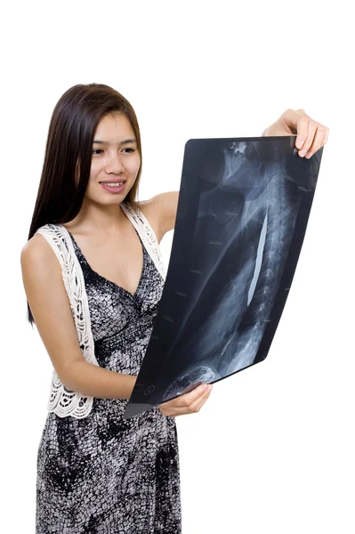 Femme est heureuse avec une radiographie — Photo