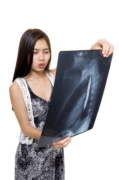 Жінка Здається Стурбована Рентгенівським Знімком Ізольована Білому Тлі — стокове фото