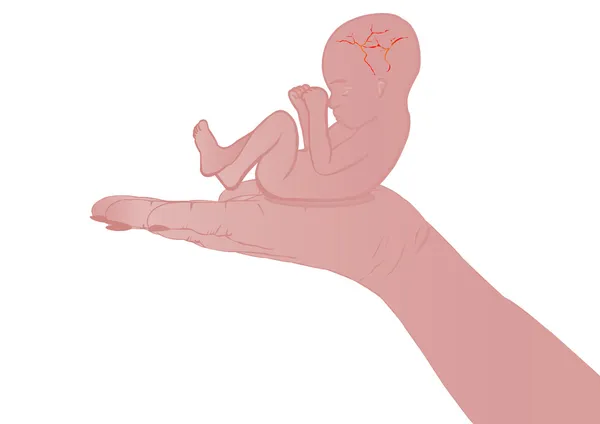 在手中的母亲的子宫中矢量插图胚芽 — 图库矢量图片