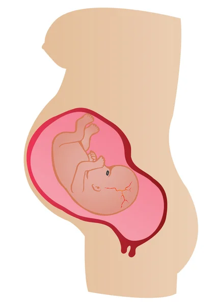 Stadi di illustrazione vettoriale di sviluppo di un germe in un utero di — Vettoriale Stock