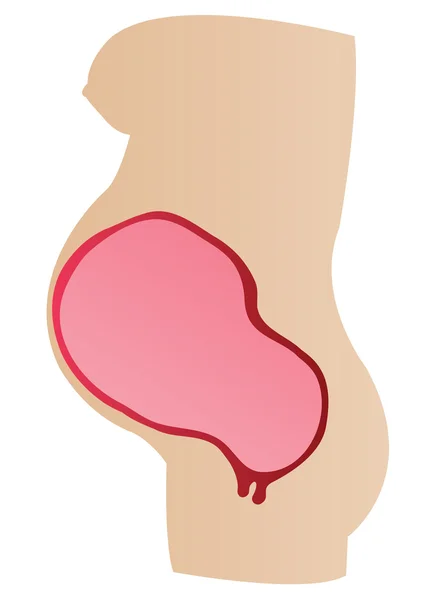 Vektor illustration arrangerar en livmoder av mamma — Stock vektor