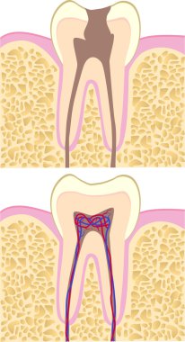 insan diş anatomisi