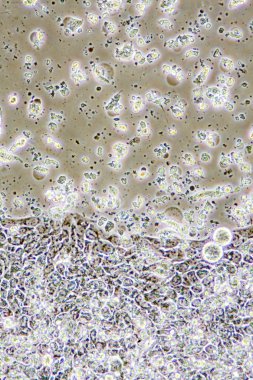 Colon Cancer cells clipart