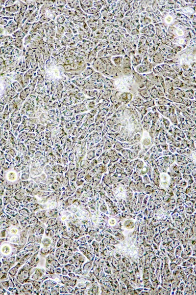 Перегляд Мікроскоп Колон Ракових Клітин Культурі Тканин Показані Стіни Ядра — стокове фото