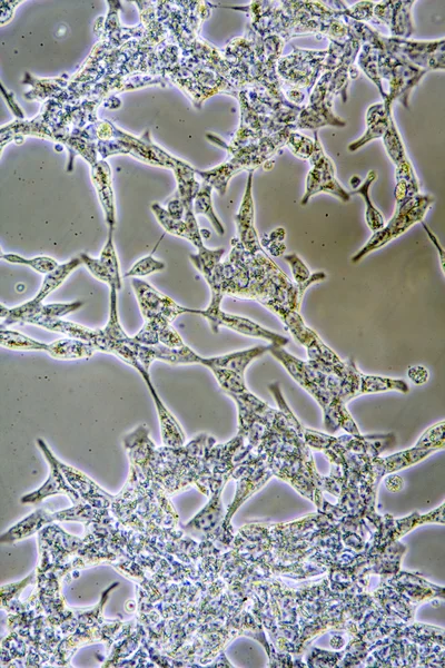 Mikroskop Ansicht Von Männlichen Prostatakrebszellen Gewebekultur Mit Wänden Zellkern Und — Stockfoto