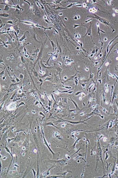 М'язові клітини — стокове фото