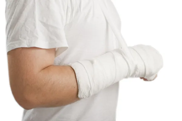 Mann mit gebrochener Hand — Stockfoto