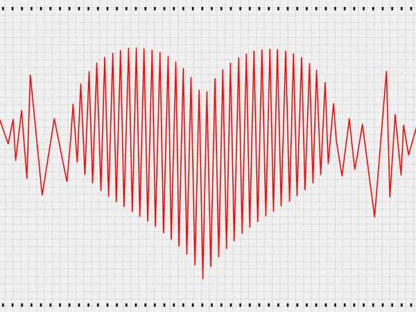 Cardiograma — Fotografia de Stock