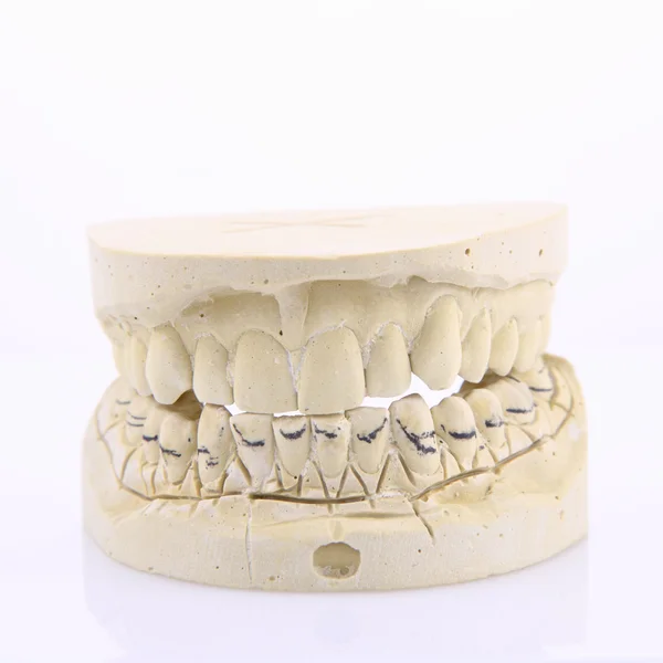 stock image Mold of teeth