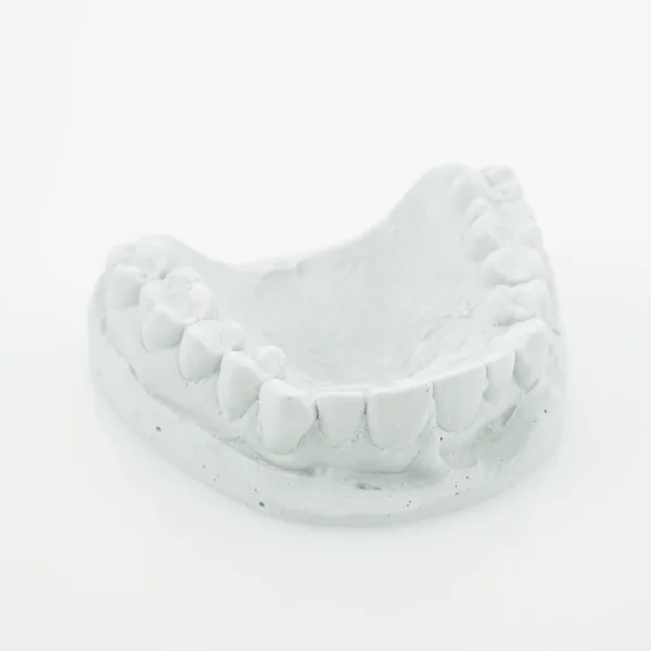 模具的牙齿 — 图库照片