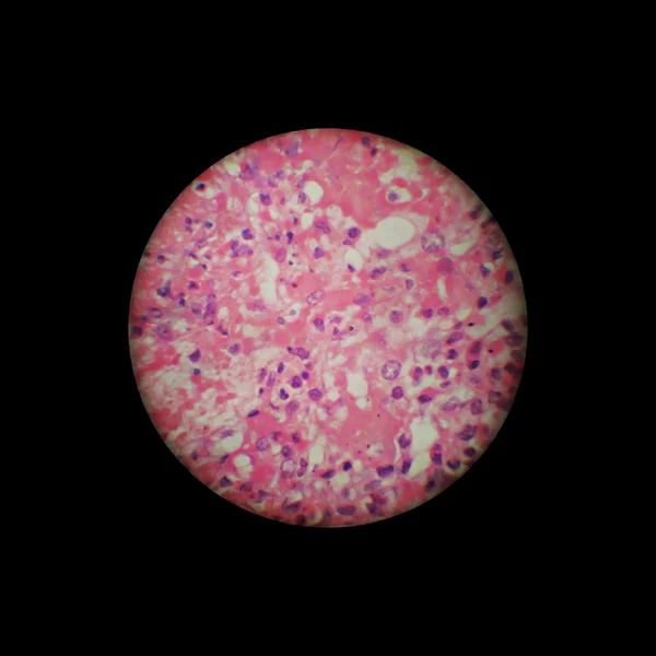 Obraz Przez Mikroskop Powiększenie — Zdjęcie stockowe