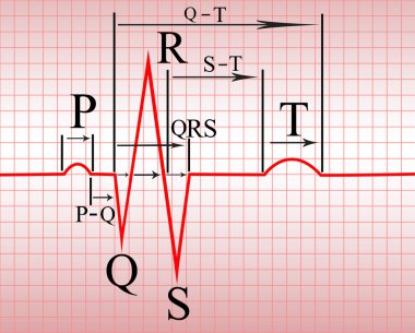 Complex of ECG on thermal paper, with the notation of teeth and spacing, illustration, vector clipart