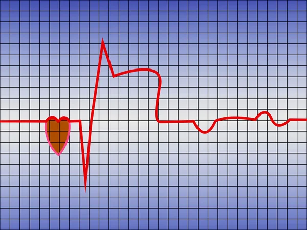 Coração de ECG — Vetor de Stock