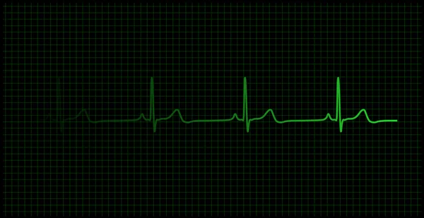 Heartbeat on the monitor vector — Stock Vector