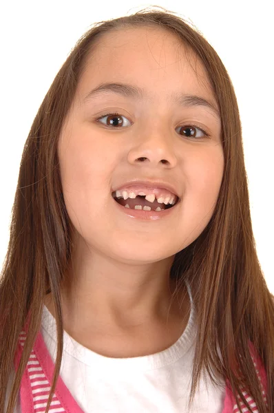 Chica perdiendo sus dientes . —  Fotos de Stock