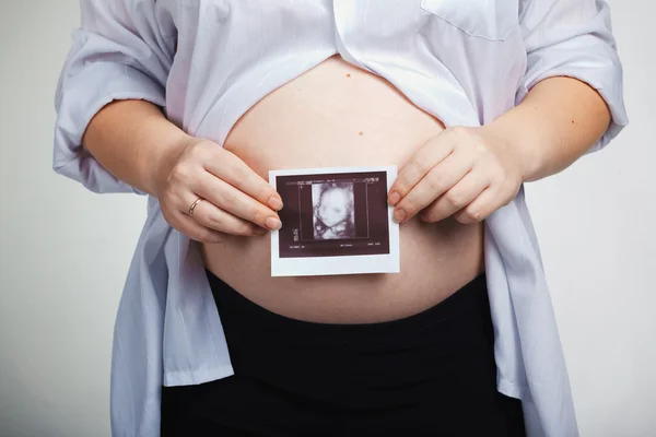 Έγκυος — Φωτογραφία Αρχείου