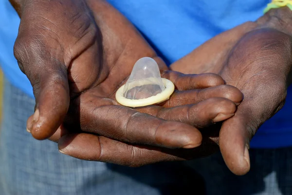 Kondom Den Händen Eines Afrikaners — Stockfoto
