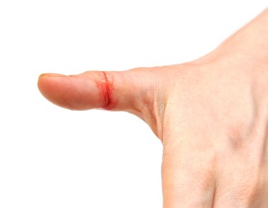 Bleeding wound on white clipart