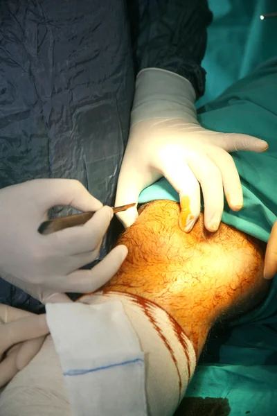 Χειρουργοί Που Κρατούν Ιατρικά Εργαλεία Στα Χέρια Και Κοιτάζουν Τον — Φωτογραφία Αρχείου