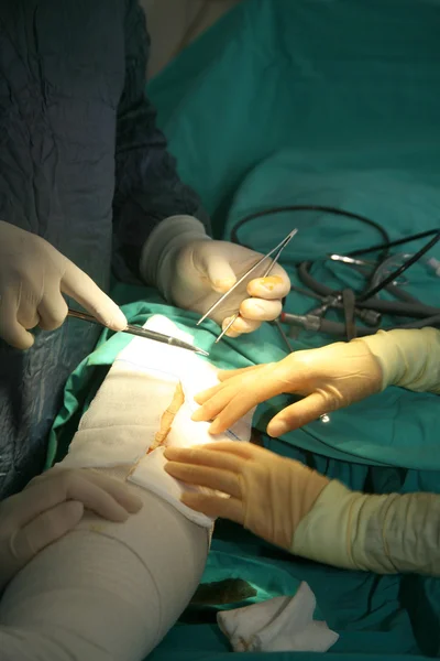 Operacja chirurgiczna — Zdjęcie stockowe