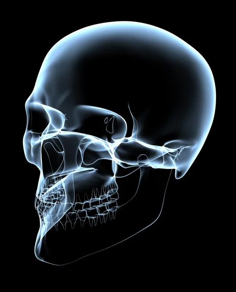 Lidská lebka - x-ray Kosoúhlé promítání — Stock fotografie