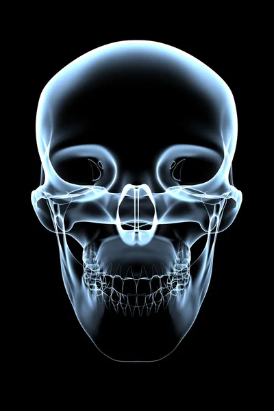 Lidská lebka - rentgenový pohled zepředu — Stock fotografie