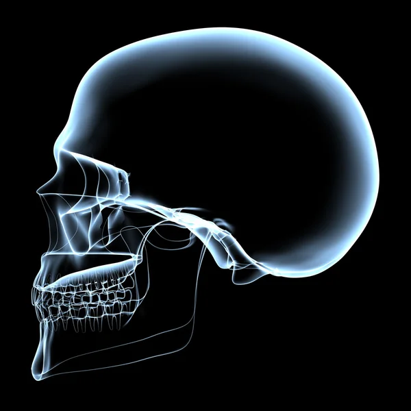 Calavera humana - Vista lateral de rayos X — Foto de Stock