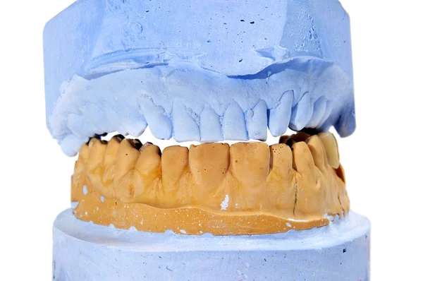 Dental mould — Stock Photo, Image