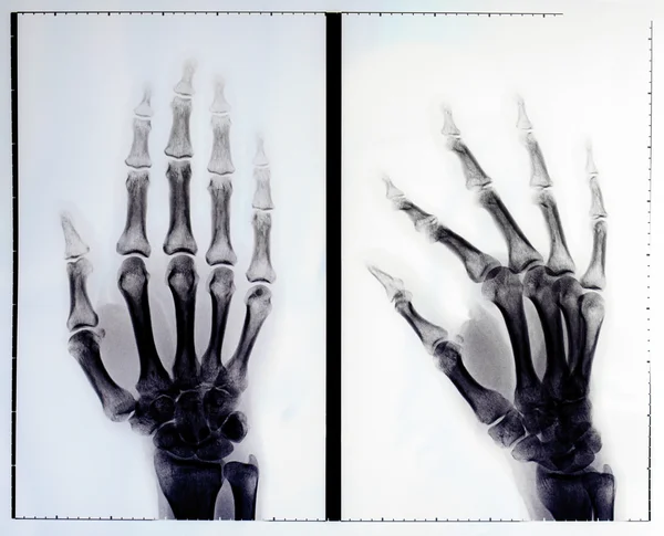 X 射线 — 图库照片
