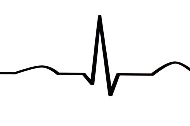 EKG diyagramı