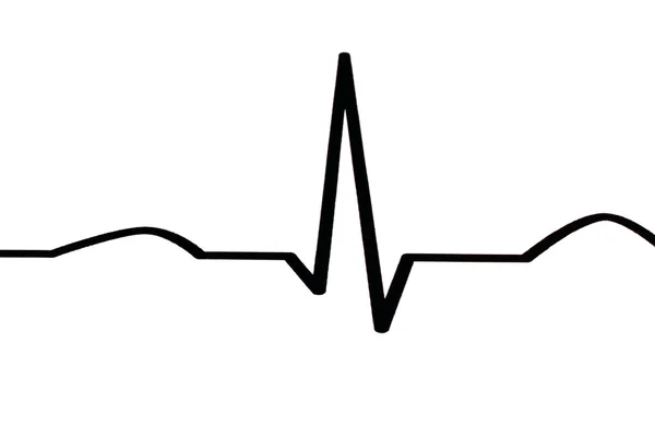 EKG diyagramı — Stok fotoğraf