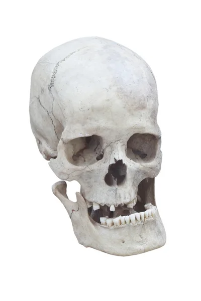 Mężczyzna czaszki — Zdjęcie stockowe