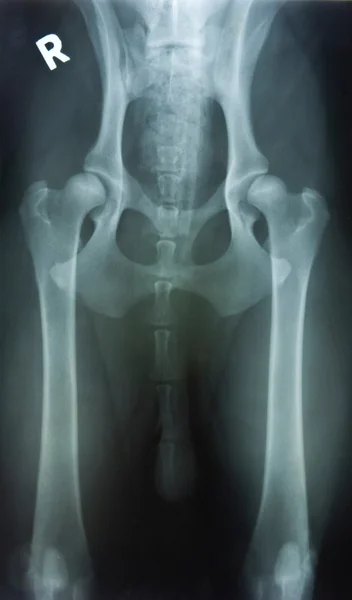 Displasia de cadera —  Fotos de Stock