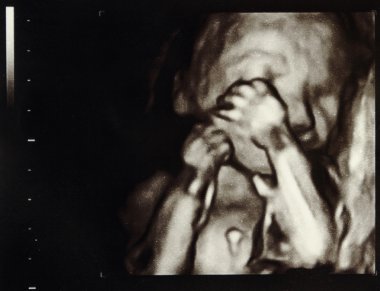 Ultrasound pregnancy clipart