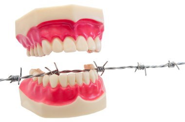 Denture on barbwire. clipart