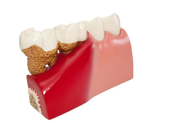Dental Modell. — Stockfoto