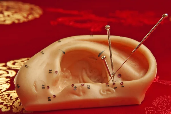Kulak akupunkturu — Stok fotoğraf