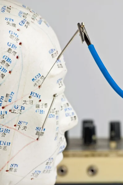 Elektrik-akupunktur — Stok fotoğraf