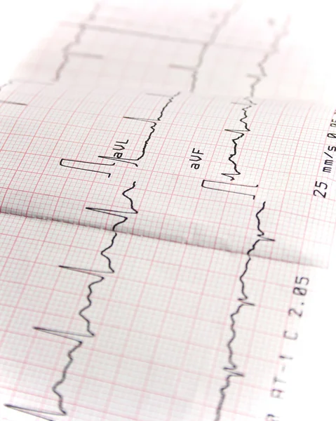 Electrocardiogramen Vit Bakgrund — Stockfoto