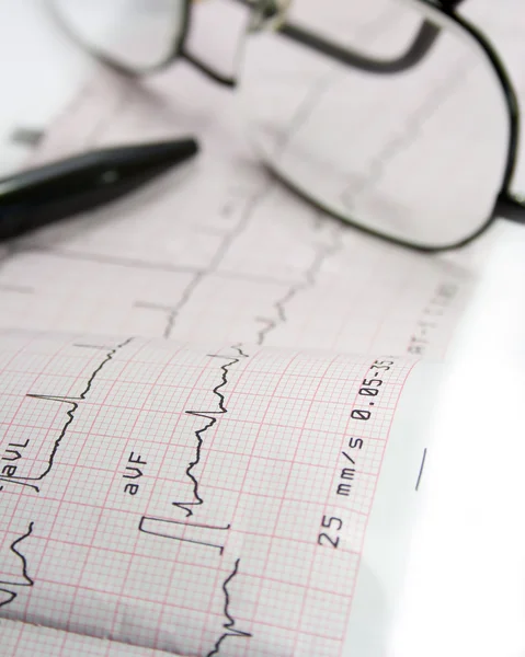 Elektrokardiogramm Auf Dem Tisch Mit Brille Und Stift — Stockfoto