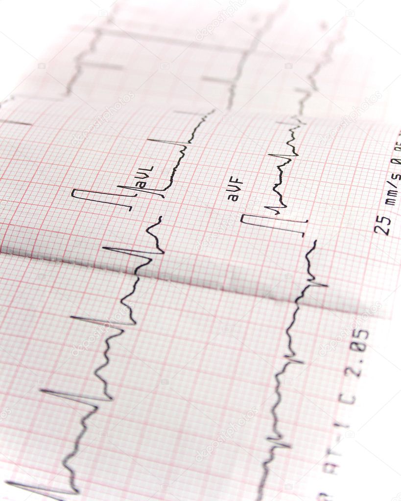 Electrocardiogram on white background