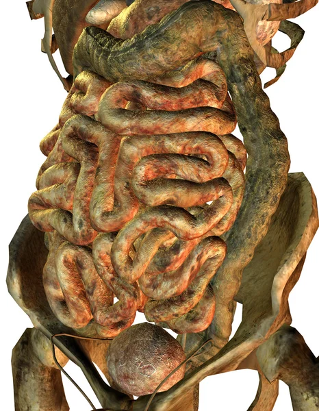 Ill male internal organs — Stock Photo, Image