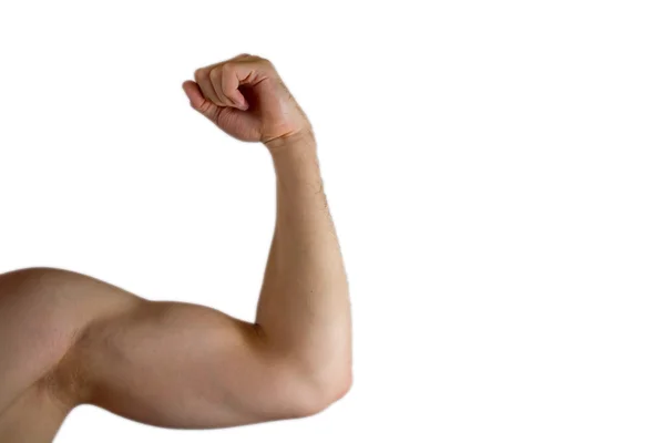 stock image Strained Biceps