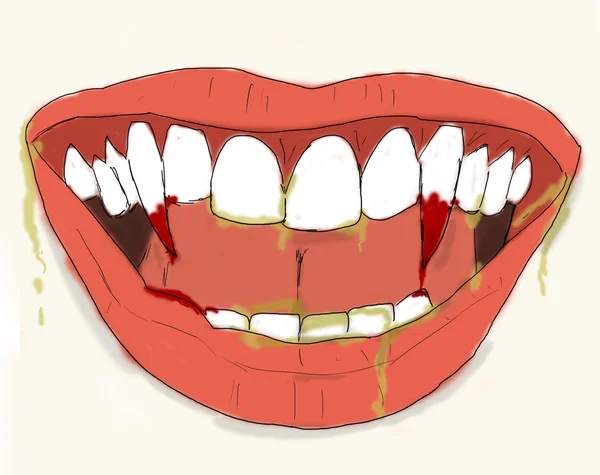 Zęby wampira — Zdjęcie stockowe