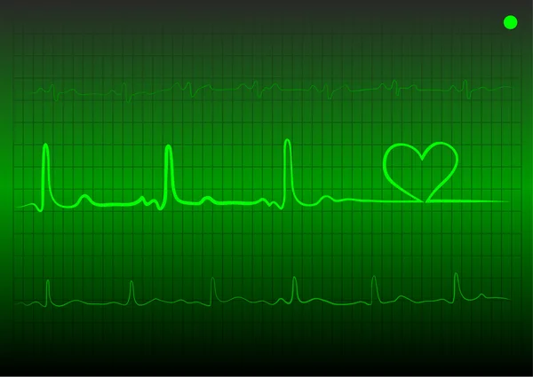 Cardiograma —  Vetores de Stock