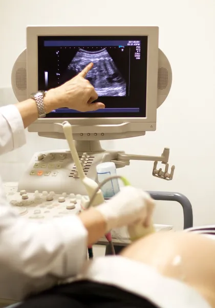 Lékařské posouzení ultrazvukové kontroly — Stock fotografie