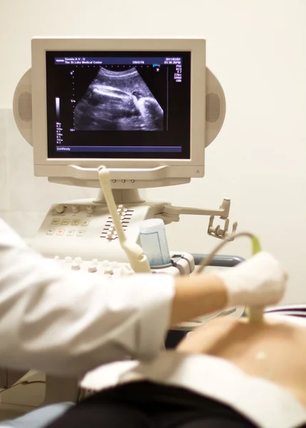 stock image Medical examining by ultrasonic scan